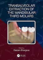 Transalveolar Extraction of the Mandibular Third Molars | کشیدن دندان مولر سوم فک پایین از طریق آلوئول